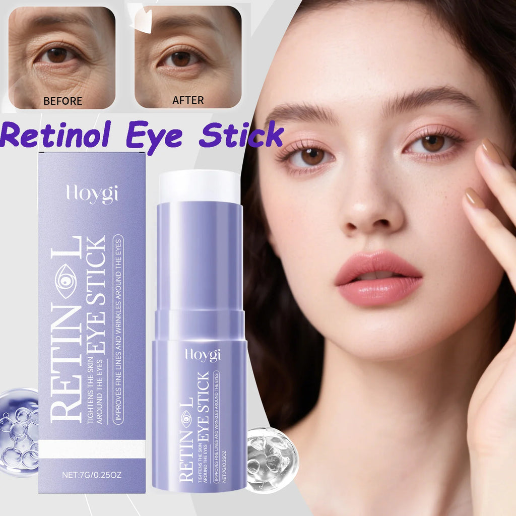 Hoygi Retinol Eye Cream Stick – Dark Circles & Anti-Aging Retinol Eye Cream Stick Zpaxo
