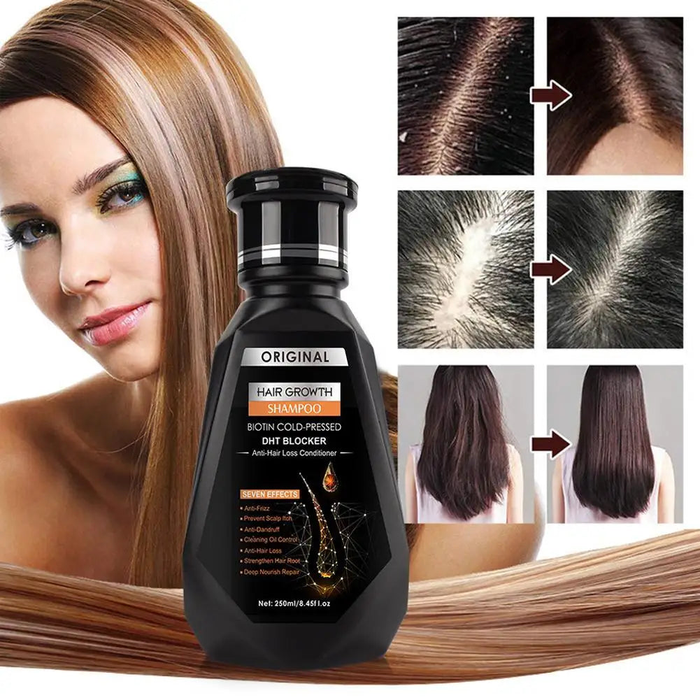 Ginger Hair Growth Shampoo – Cleanse, Soothe & Stimulate Hair Growth Shampoo Zpaxo