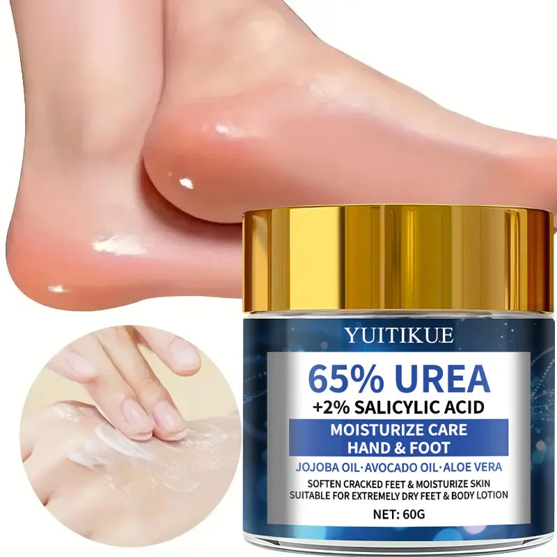 YUITIKUE 65% Urea Foot Cream – Cracked Heel Repair, 60g Urea Foot Cream Zpaxo Default Title