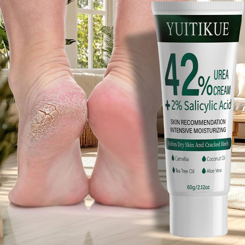 YUITIKUE 42% Urea Cream – Cuticle Softener & Dry Skin Relief 60g Urea Foot Cream Zpaxo Default Title