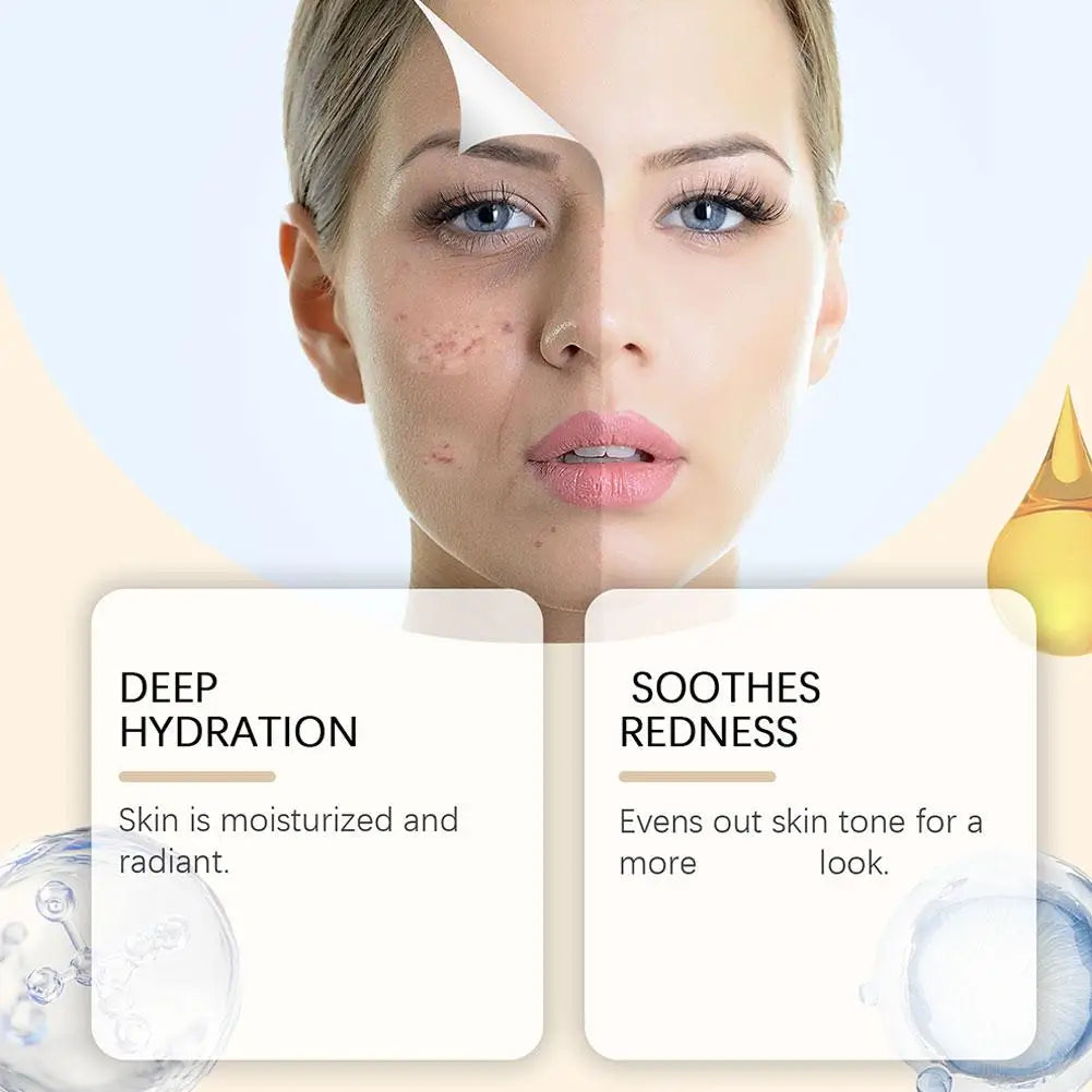 Deep Moisturizing Soothing Face Spray 100ml – Calm Redness Facial Mist Spray Zpaxo
