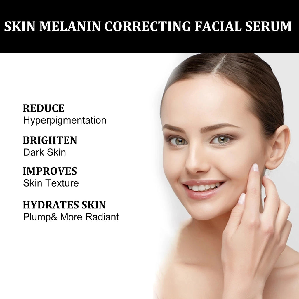 Melanin Correcting Facial Serum Fade Dark Spots Anti Freckle Lightening Pigment Blemish Niacinamide Brightening Face Serum Zpaxo