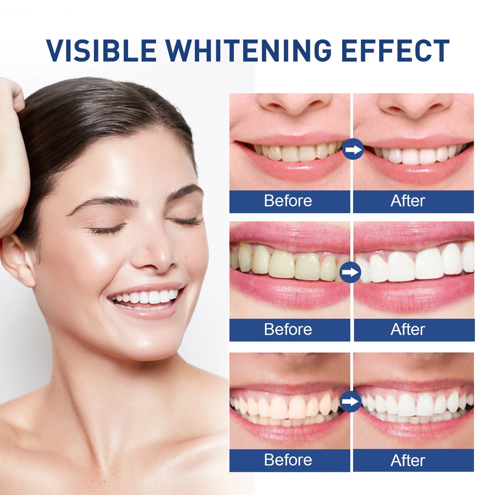 Instant Teeth Whitening Paint 5ml Remove Stains and Yellow Teeth Fast Acting Smile Brightener No Sensitivity Vegan Formula Zpaxo