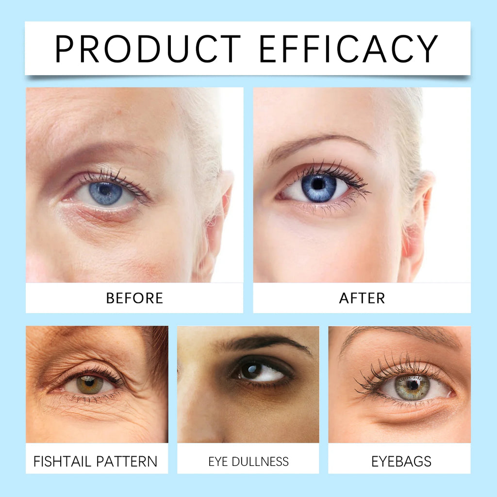 Eye Patches Dark Circles Puffiness with Hydrating Gel Technology Soothing Fine Lines Care for Sensitive Dry Skin Women 60 Pcs Zpaxo