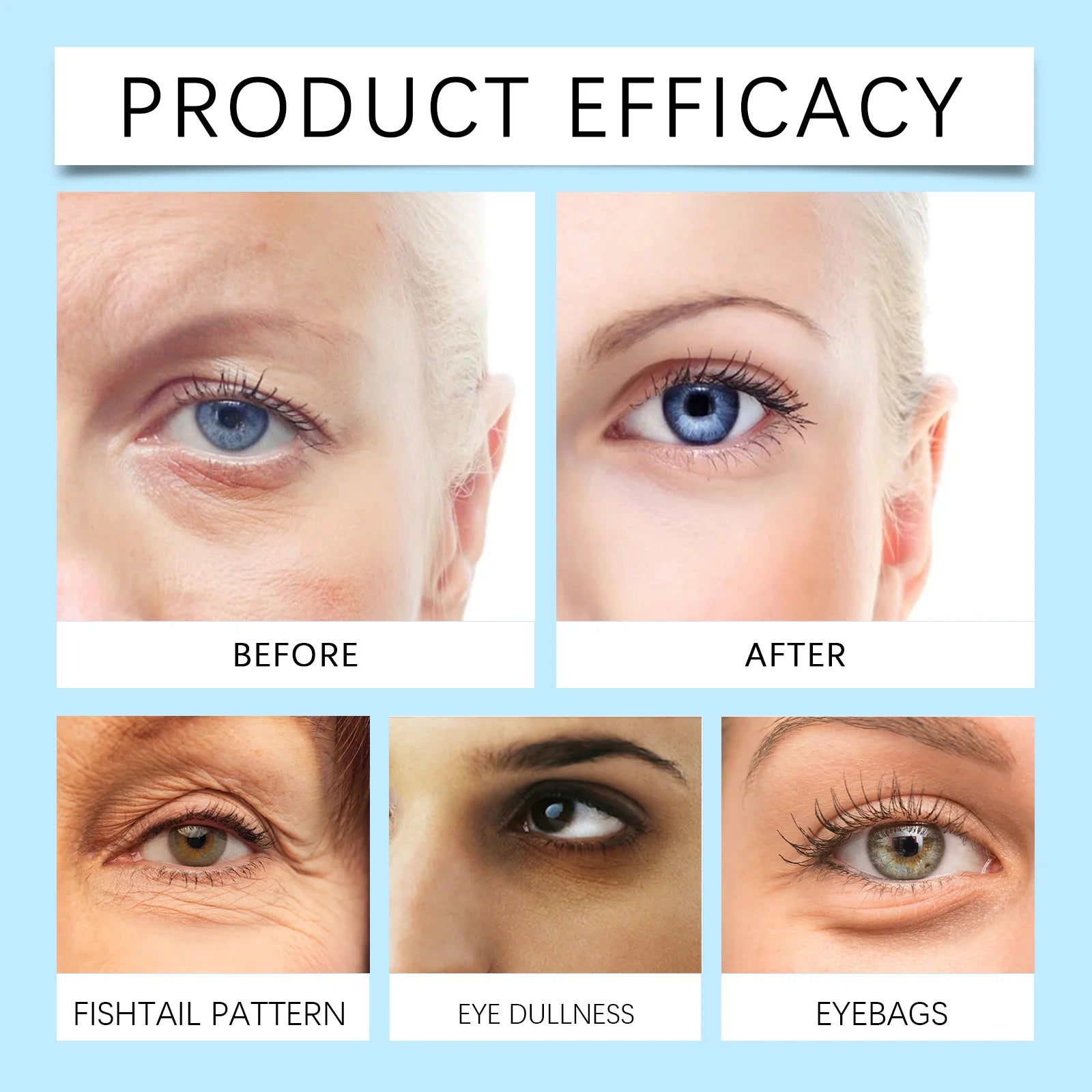 Eye Patches Dark Circles Puffiness with Hydrating Gel Technology Soothing Fine Lines Care for Sensitive Dry Skin Women 60 Pcs Zpaxo
