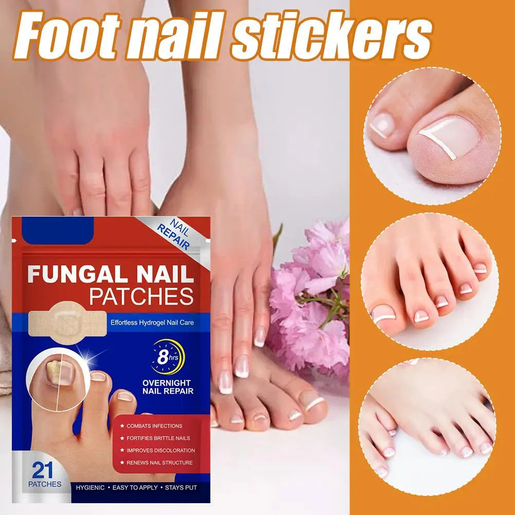 Foot Nail Repair Patches Nail Ingrown Correction Sticker Antifungals Toenail-Fungus Treatments Stickers Damaged Nail Care Tool Zpaxo