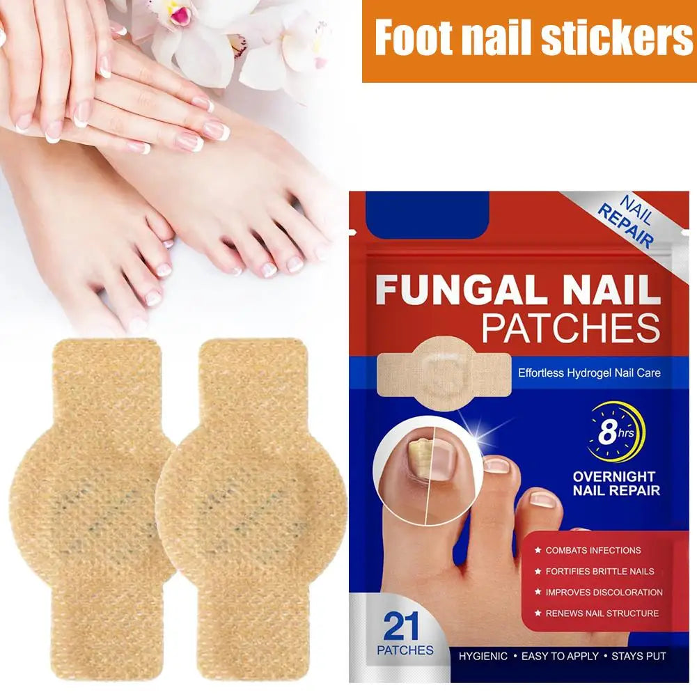 Foot Nail Repair Patches Nail Ingrown Correction Sticker Antifungals Toenail-Fungus Treatments Stickers Damaged Nail Care Tool Zpaxo