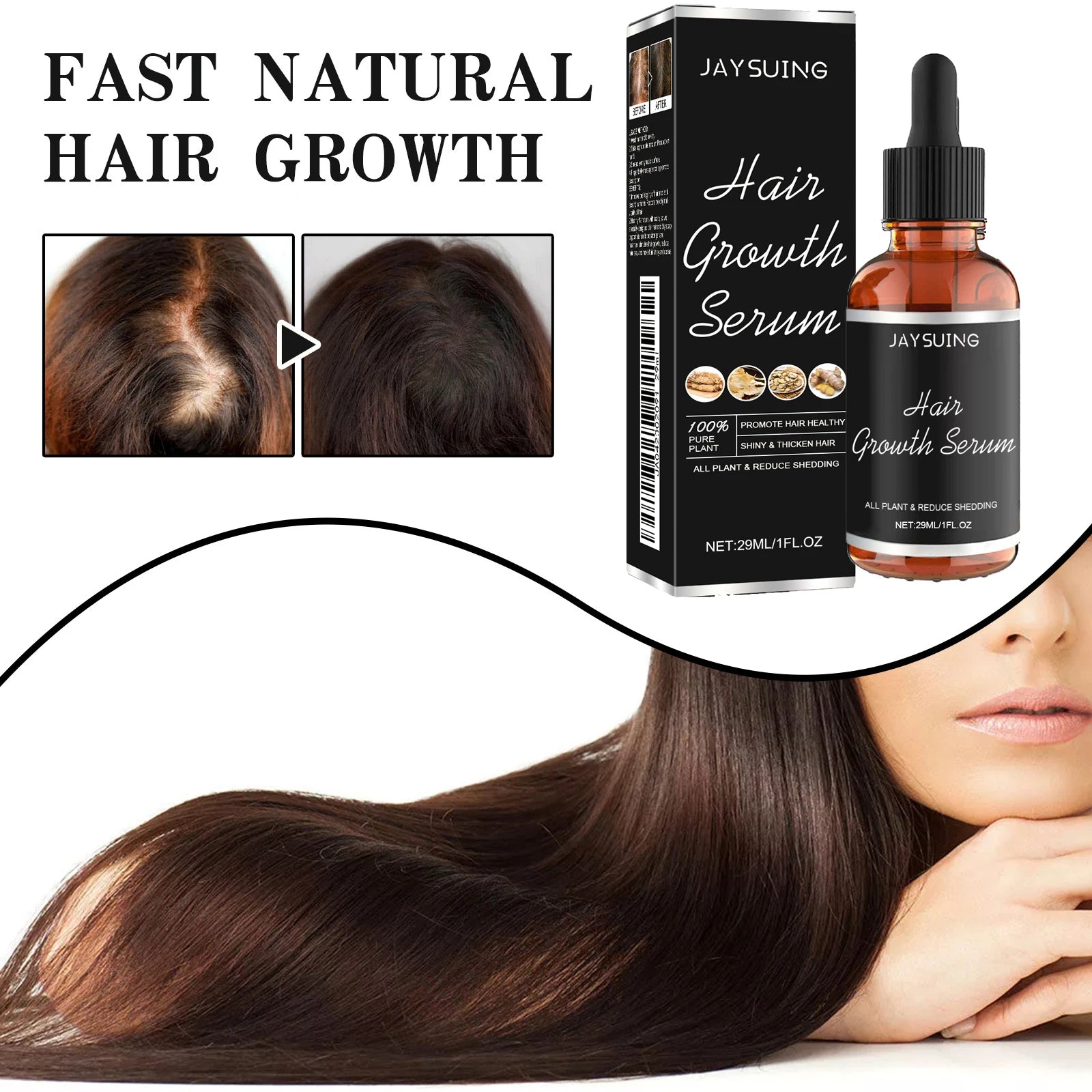 Hair Loss-Reducing Hair Essence, Gentle Nourishment for Scalp, Massage Care for Smooth and Moisturized Hair, Nourishing Hair Oil Zpaxo