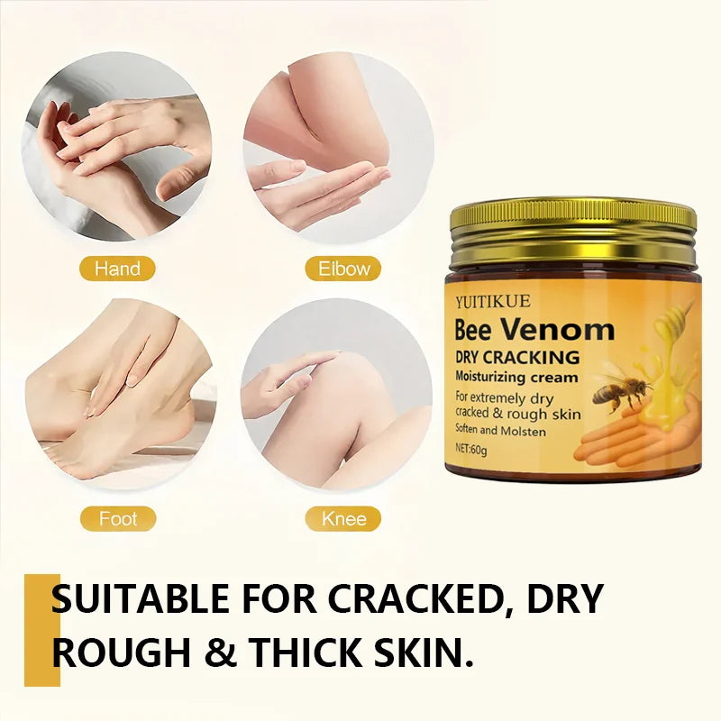 YUITIKUE Bee Venom Repair Cream 60g – Cracked Skin Treatment Skin Repair Cream Zpaxo