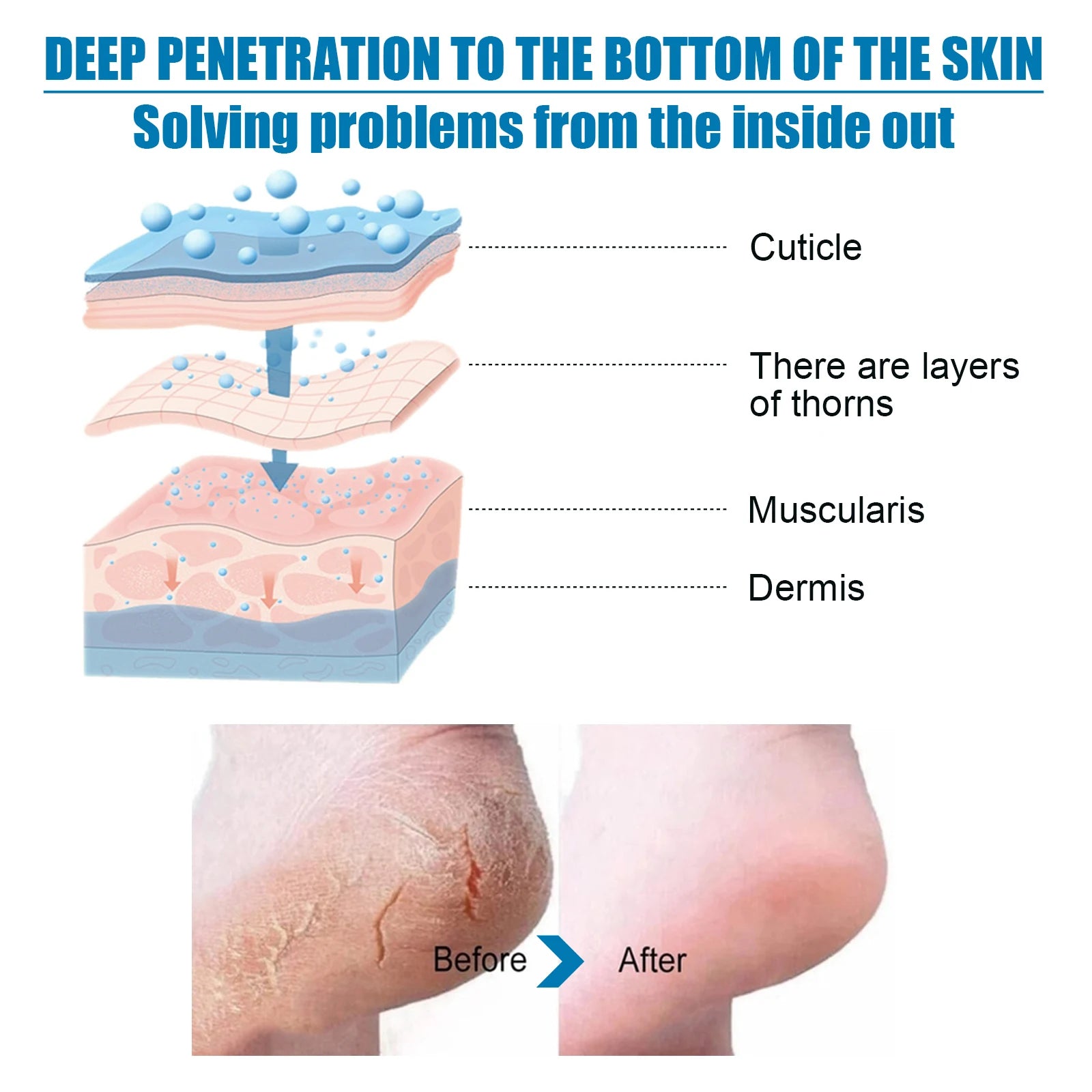 1 Pair Foot Mask Exfoliating For Feet Pedicure Foot Peel Exfoliating Callus Booties Peeling Off Calluses Dead Skin Spa Mask Zpaxo