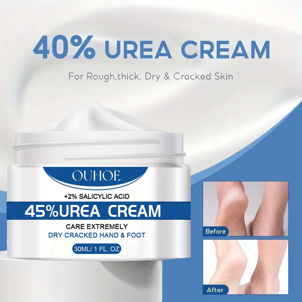 Intensive Foot Hand Cream Dry Cracked Skin Deep Moisture Repair Zpaxo