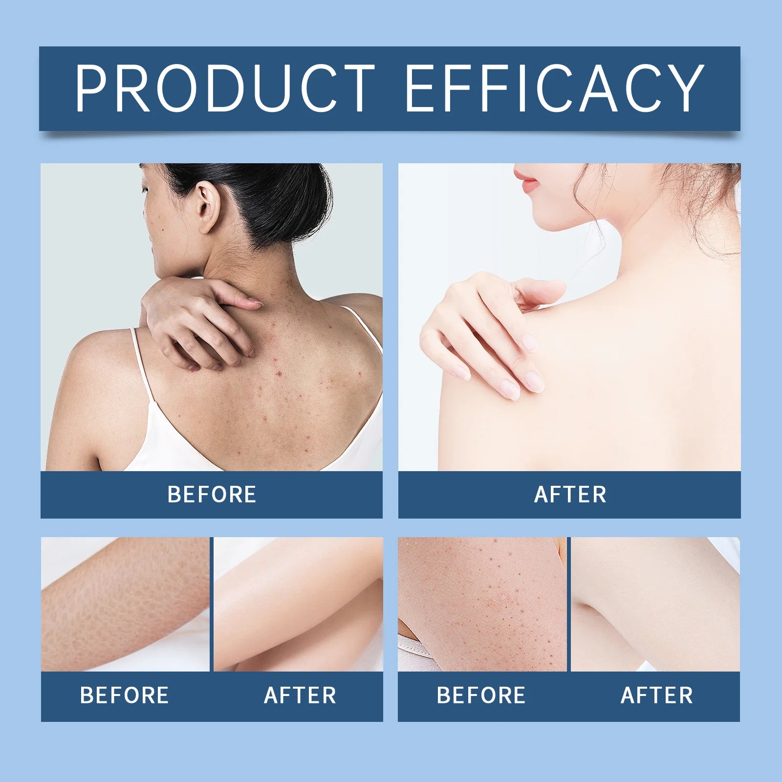 Targeted Brightening Body Serum Dark Spot Corrector for Inner Thighs & Underarms Hydrating Moisturizer for Even Skin Travel Size Zpaxo