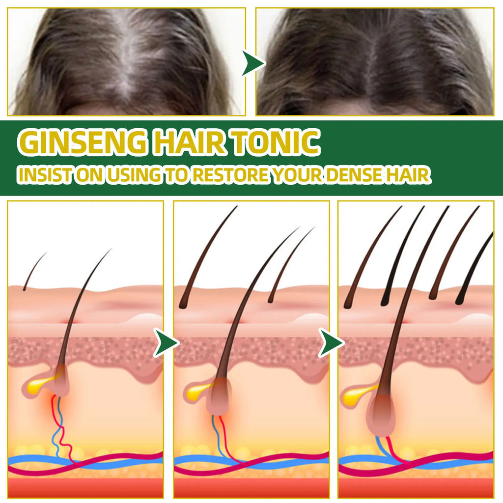 Ouhoe Ginseng Hair Growth Serum 100ml Nourish Scalp Bioactive Formula Promote Hair Regrowth Reduce Hair Fall Strengthen Roots Zpaxo
