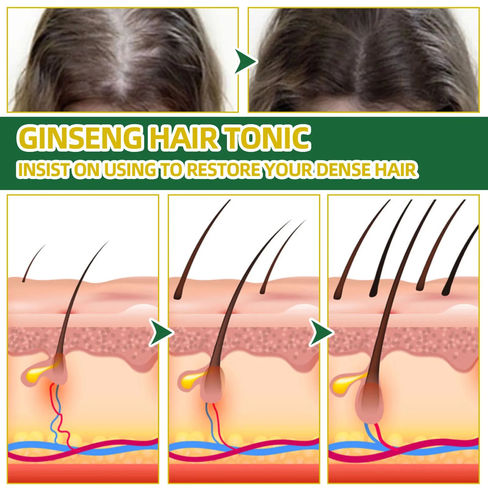 Ouhoe Ginseng Hair Growth Serum 100ml Nourish Scalp Bioactive Formula Promote Hair Regrowth Reduce Hair Fall Strengthen Roots Zpaxo