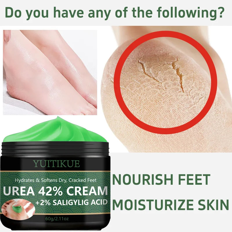 YUITIKUE 42% Urea Foot Cream – Callus & Dry Skin Relief Urea Foot Cream Zpaxo