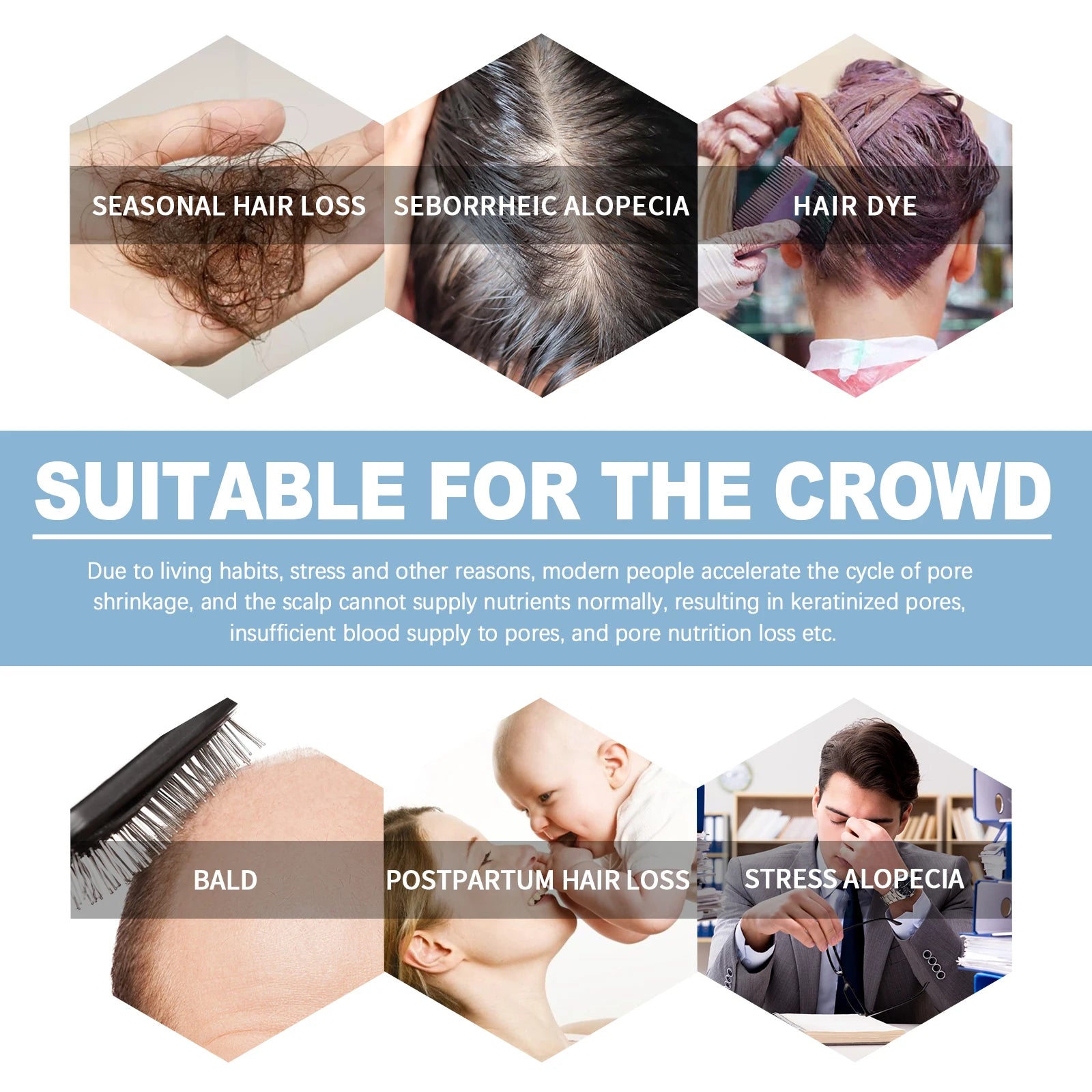 Hair Growth Ampoules Regrowth Anti Hair Loss Repair Split End Dry Damaged Hair Essential Oil Nourishing Scalp Portable Hair Care Zpaxo