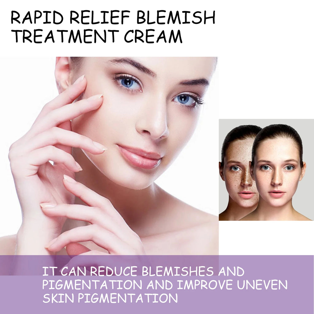 Dark Spot Correcting Brightening Cream 20g Hydrating Face Cream Fades Appearance of Spots Evens Tone Boosts Radiance Acid Aloe Zpaxo