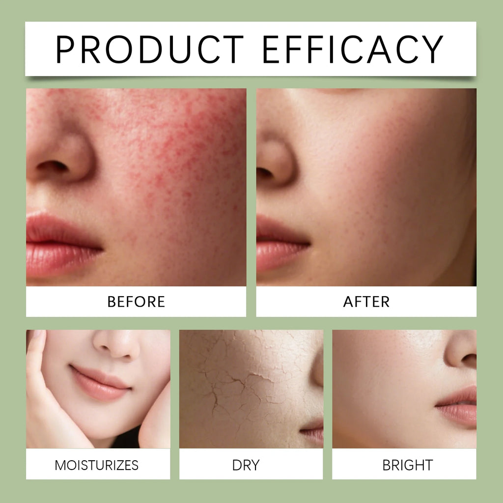 100ml Gel Toner Mist for Face Soothing Hydrating Facial Spray Calm Sensitive Skin Support Barrier with Refreshing Cooling Effect Zpaxo