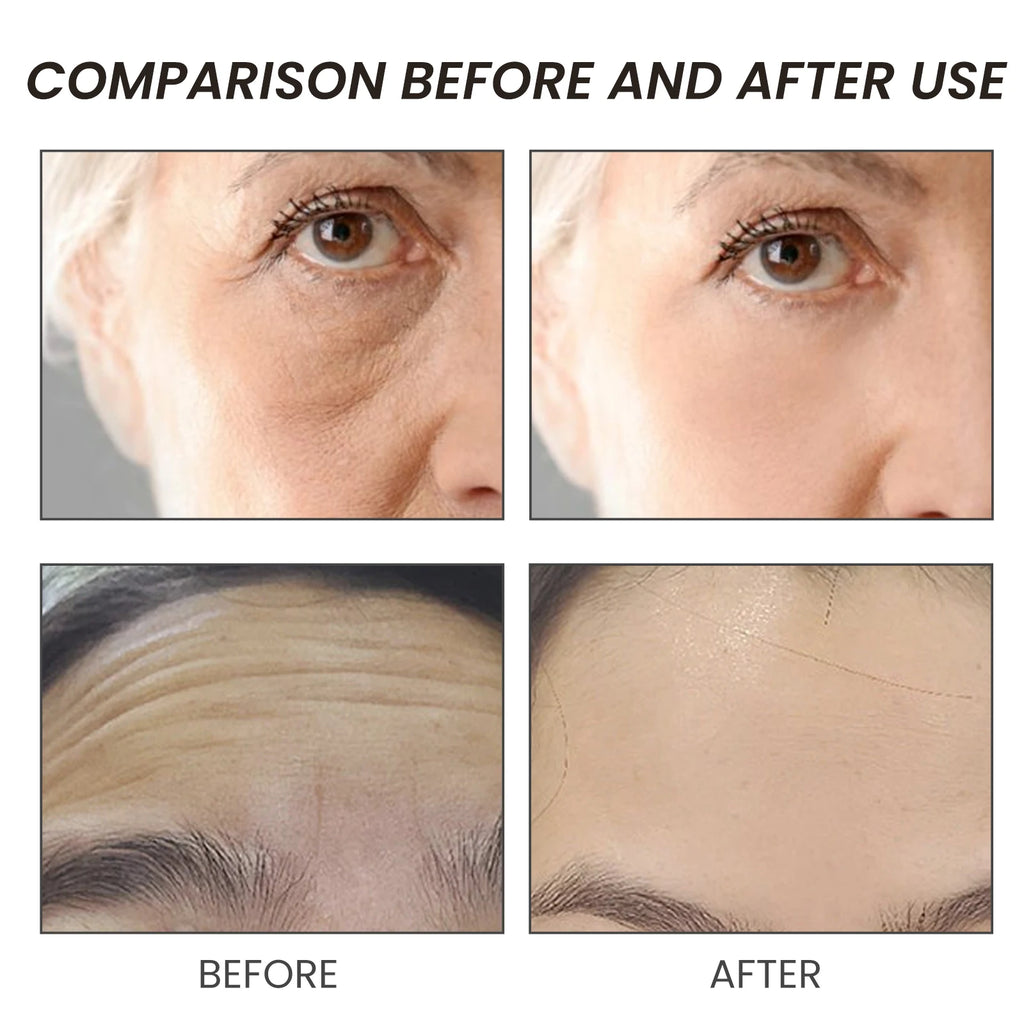 Anti Aging Face Serum with Bee Venom and Panthenol Firming Wrinkle Reducing Hydrating Essence for Youthful Glow Skin Care 15ml Zpaxo