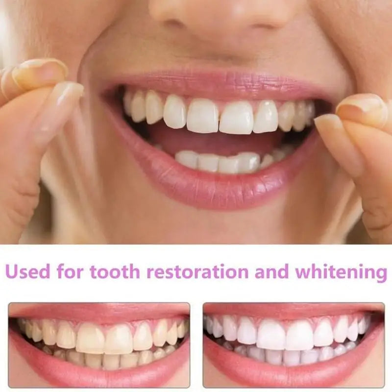 Snap-On Teeth Veneers – Reusable Temporary Smile Veneers Cosmetic Tooth Veneers Zpaxo