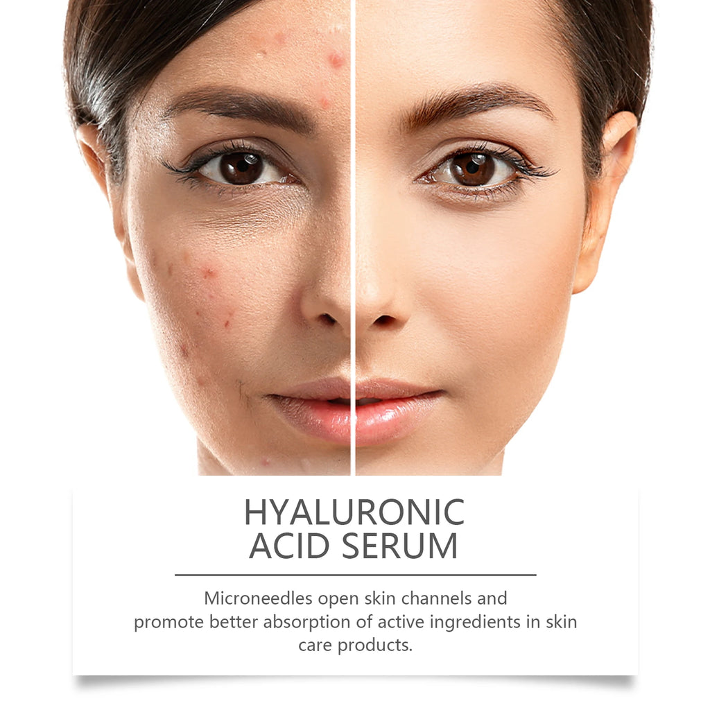 Facial Roller Serum Hydrating Winter Skincare Cold Weather Zpaxo