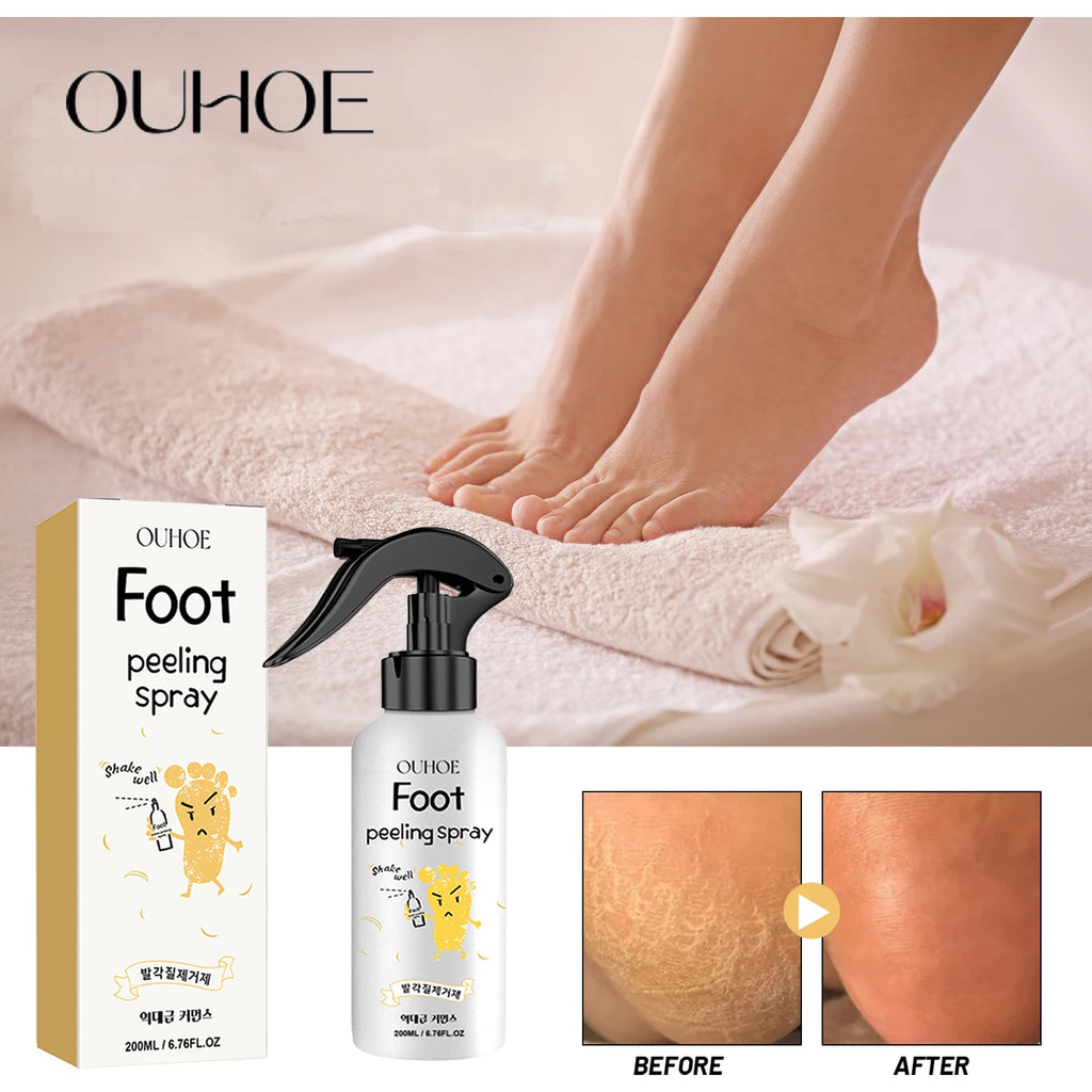 Ouhoe Foot Exfoliating Spray 72H Moisture Lock Callus Softener Anti Dry Crack Repair Odor Control Brightening Foot Care Liquid Zpaxo