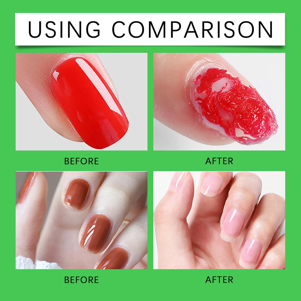 Gentle Nail Gel Remover Soak Off Solution for Acrylic Builder Gel Easy Removal Without Damaging Nails No Residue Fast Acting 8ml Zpaxo