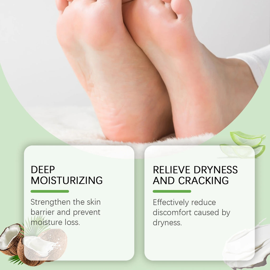 WIYUN 40% Urea Foot Cream – Cracked Heels & Callus Repair Urea Foot Cream Zpaxo
