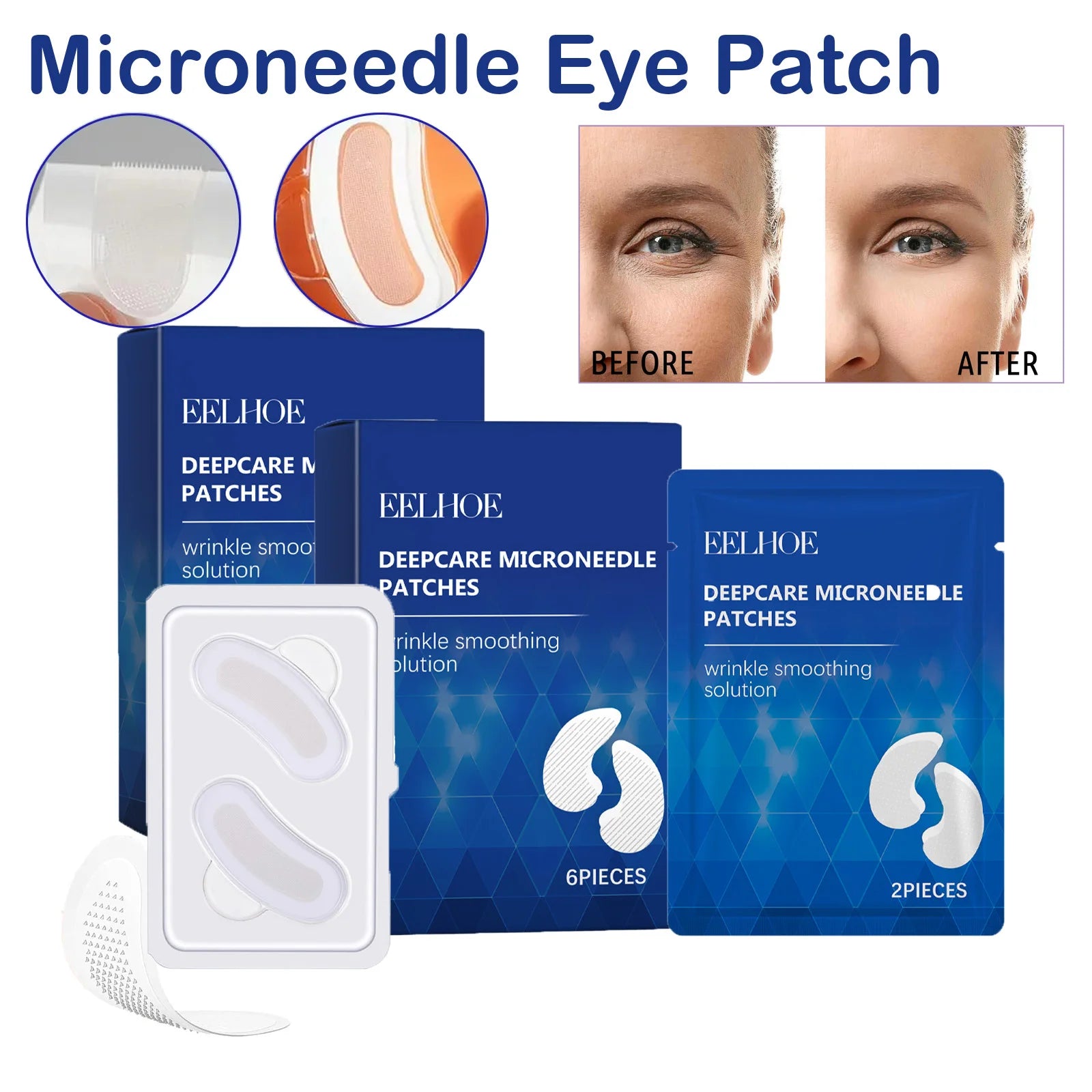 Hyaluronic Acid Microneedle Eye Patches – Dark Circles & Anti-Aging Microneedle Eye Patches Zpaxo