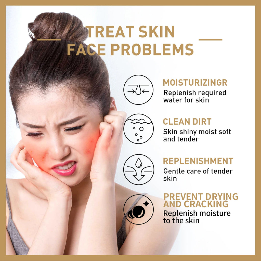 Eelhoe Rice Toner – Brightening, Moisturizing & Firming 150ml Facial Toner Zpaxo