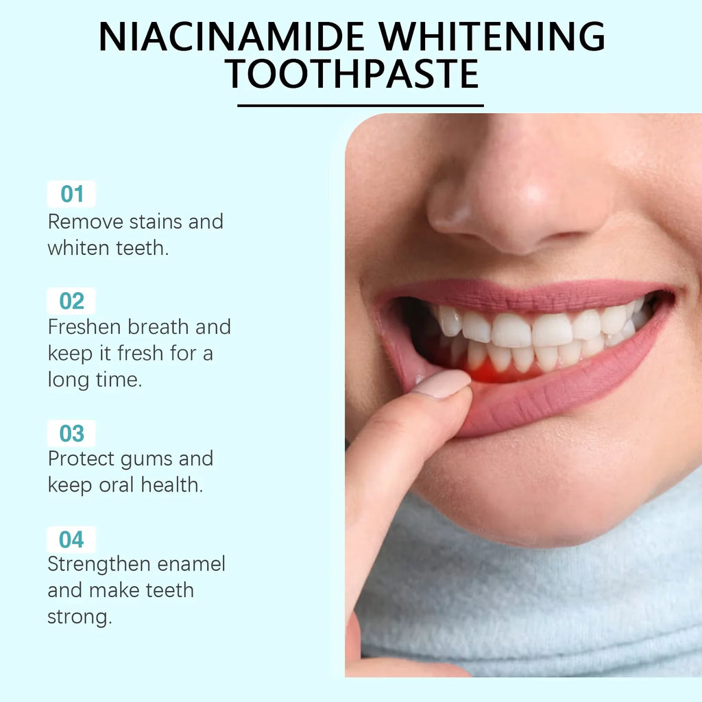 Oralhoe Nicotinamide Whitening Toothpaste – Remove Plaque Whitening Toothpaste Zpaxo
