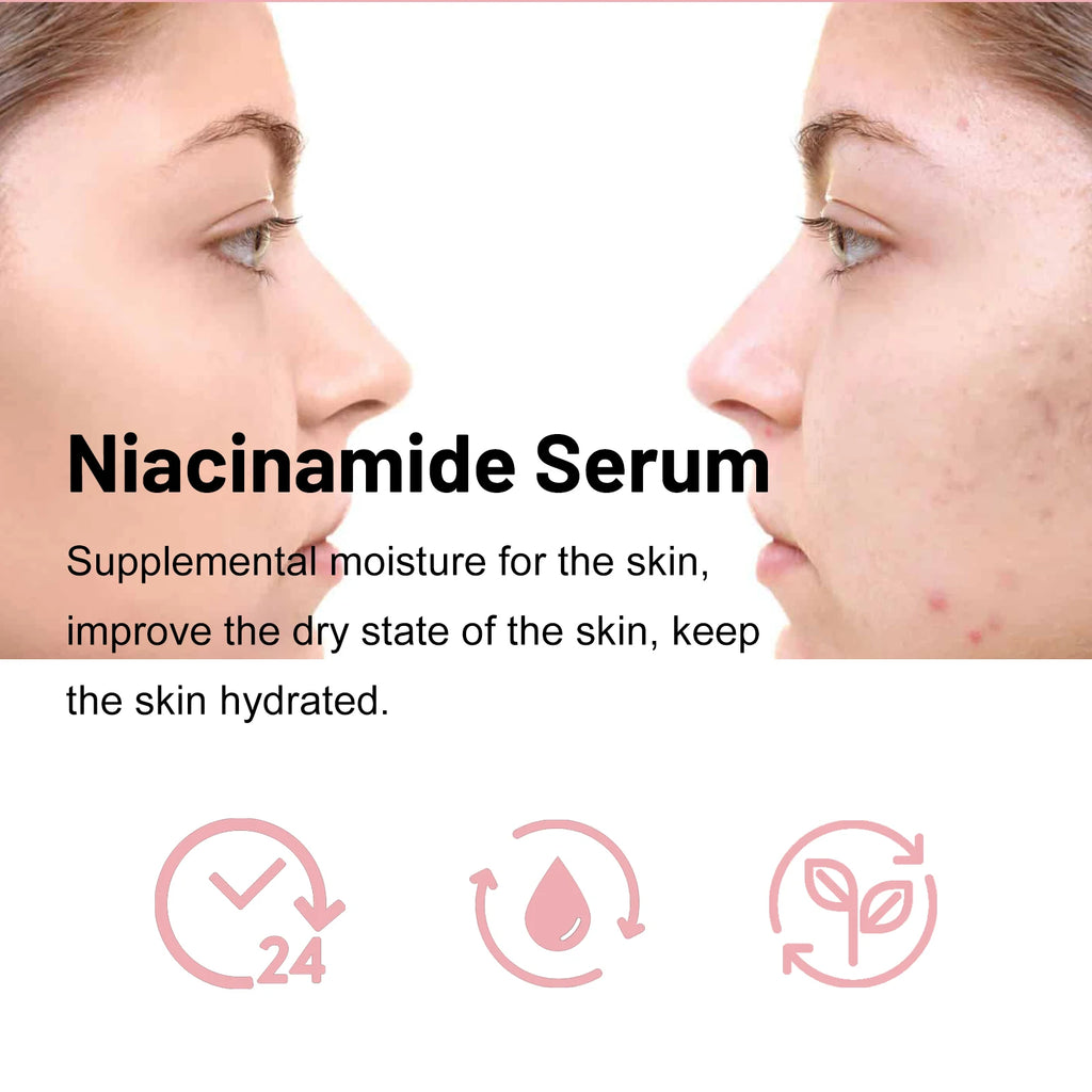 Nicotinamide Brightening Serum Nourishing Gentle Moisturizing Firming Tender Anti-Aging Wrinkle Shrink Pores Long Repair Essence Zpaxo