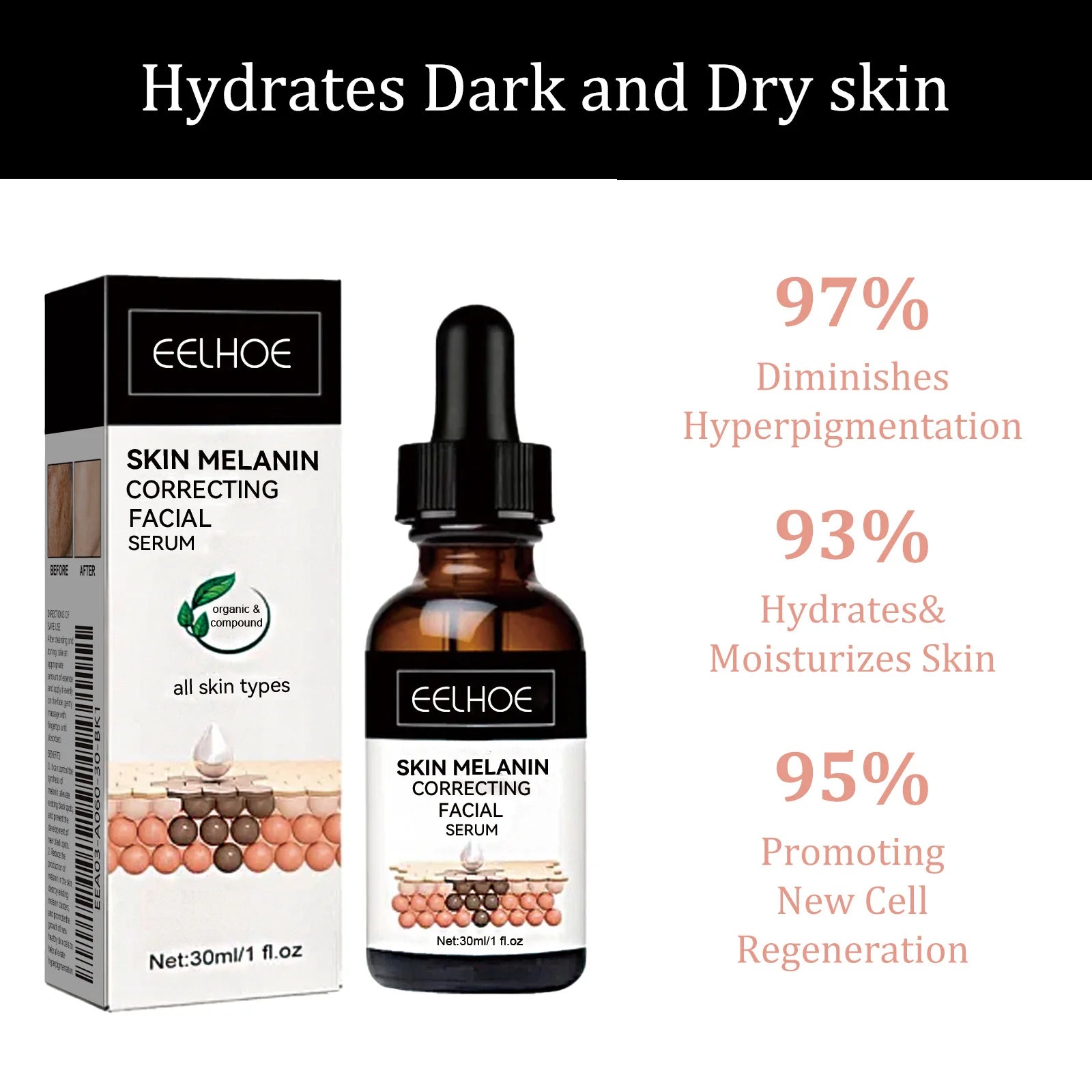 Melanin Correcting Facial Serum Fade Dark Spots Anti Freckle Lightening Pigment Blemish Niacinamide Brightening Face Serum Zpaxo