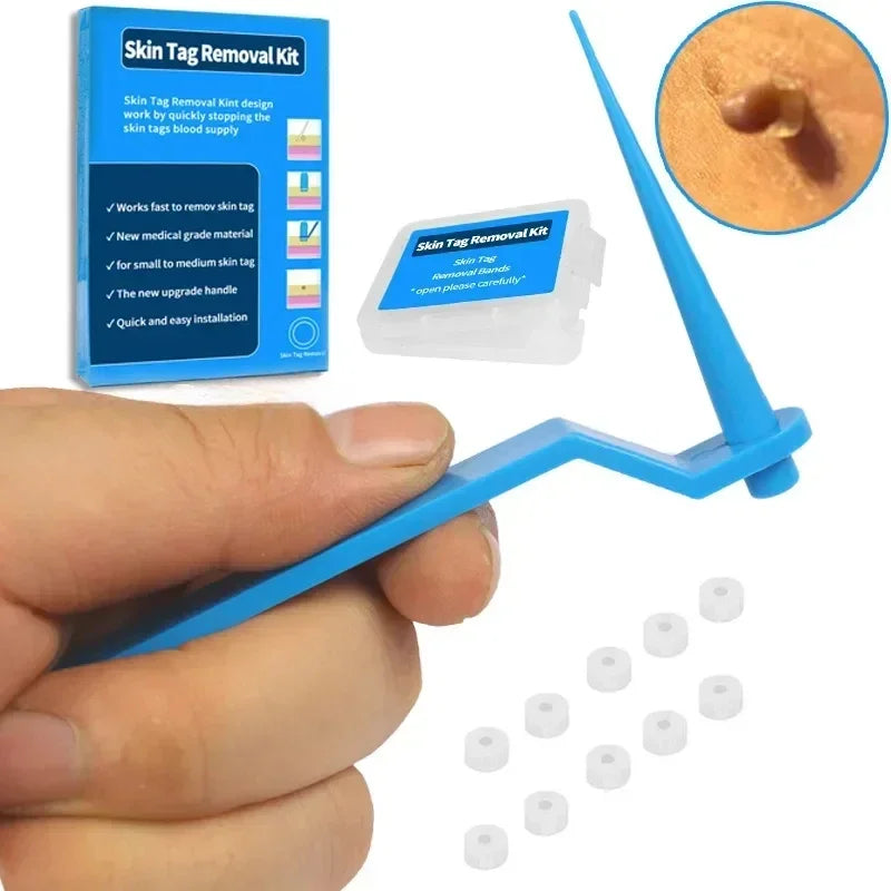 1 Set Skin Tag Removal Kit Skin Mole Wart Remover Micro Band Skin Tag Removal Kit Tag Treatment Tools Set with Cleansing Swabs Zpaxo