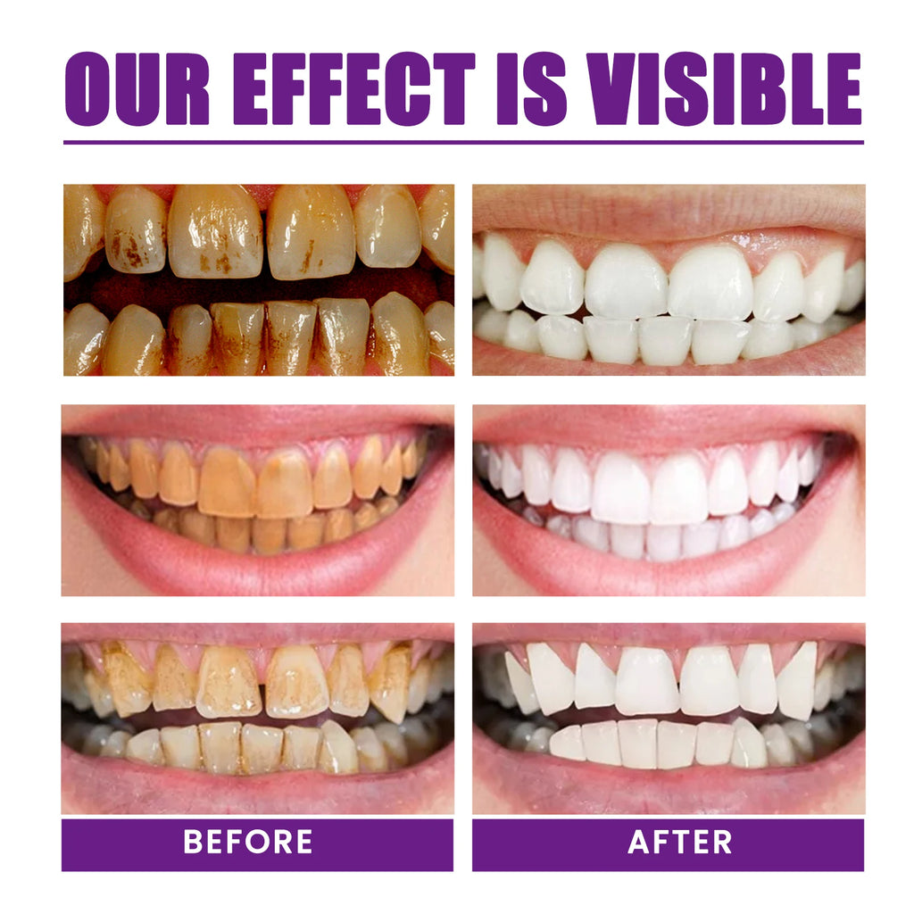 Premium Purple Brightening Toothpaste, Removes Surface Stains & Oral Odor, Gentle Gum Care, Daily Brightening & Refreshing Teeth Zpaxo