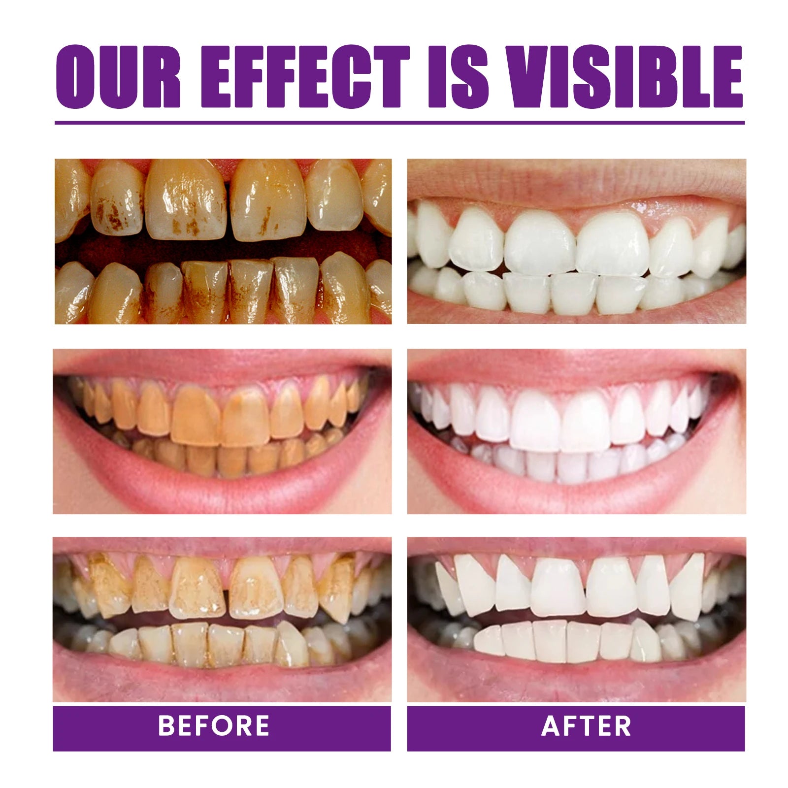 Premium Purple Brightening Toothpaste, Removes Surface Stains & Oral Odor, Gentle Gum Care, Daily Brightening & Refreshing Teeth Zpaxo