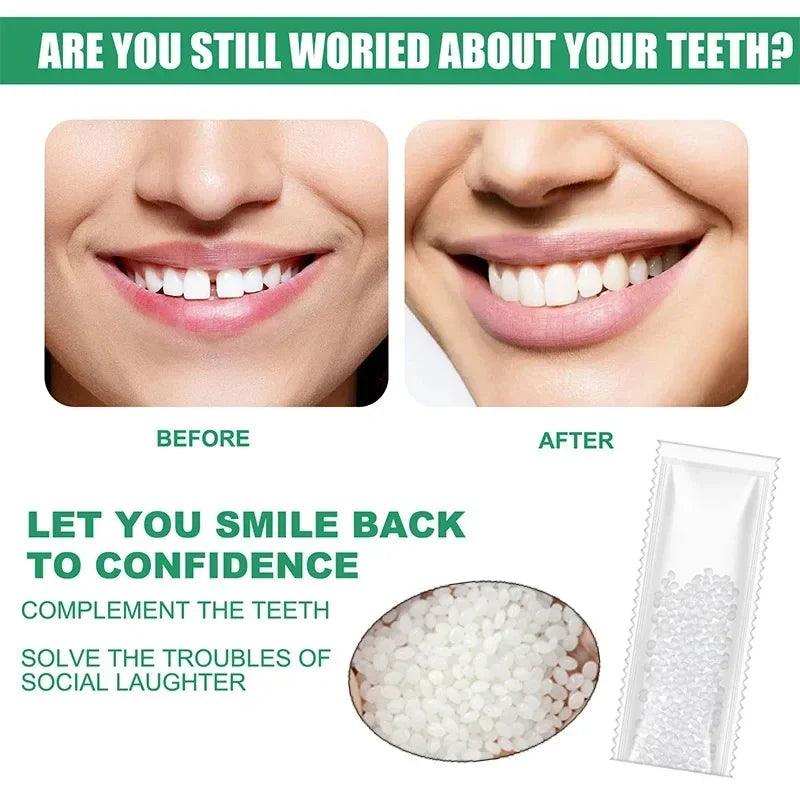 Temporary Tooth Repair Kit – Moldable Resin Dental Adhesive