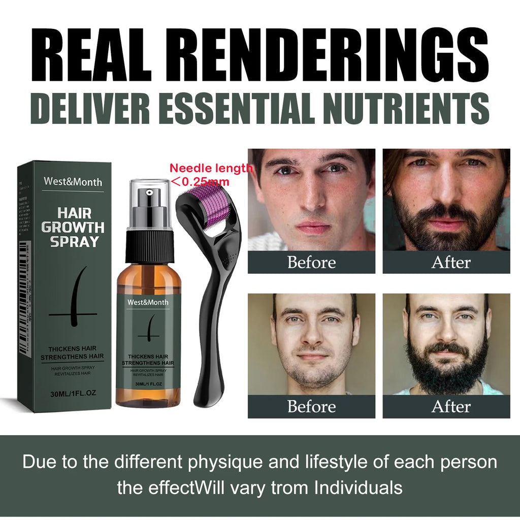 Men's Beard Growth Spray Kit with 0.25mm Micro Roller – WEST MONTH Beard Growth Kit Zpaxo
