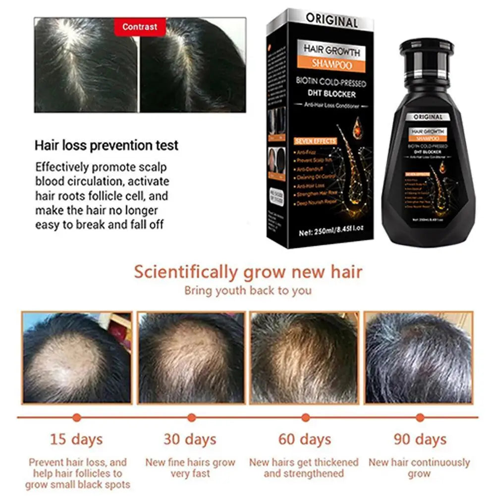 Ginger Hair Growth Shampoo – Cleanse, Soothe & Stimulate Hair Growth Shampoo Zpaxo