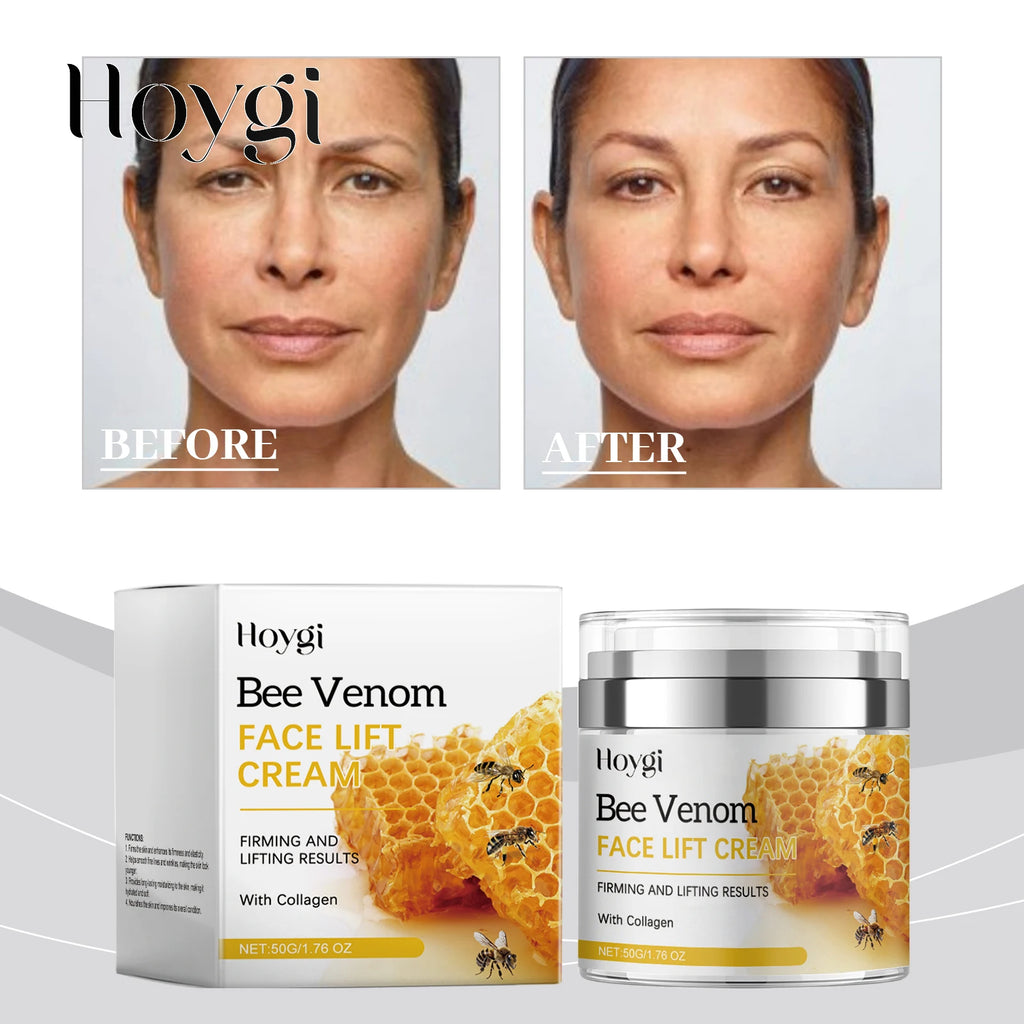 Hoygi Bee Venom Firming Lifting Face Cream Hydrate Nourish Boost Elasticity Reduce Gentle Daily Moisturizer for All Skin Types Zpaxo