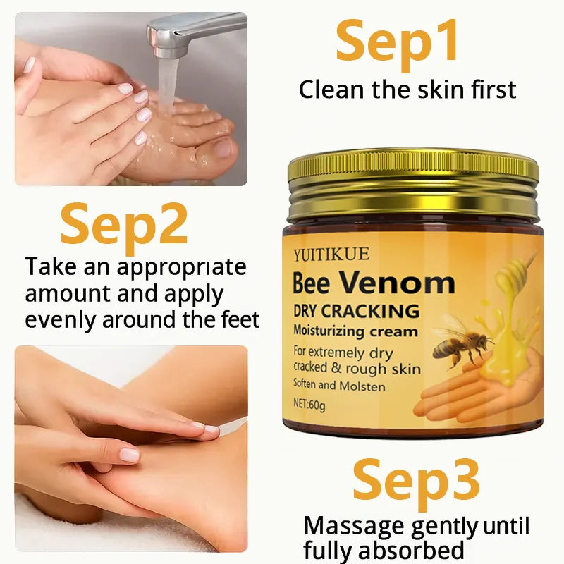 YUITIKUE Bee Venom Repair Cream 60g – Cracked Skin Treatment Skin Repair Cream Zpaxo