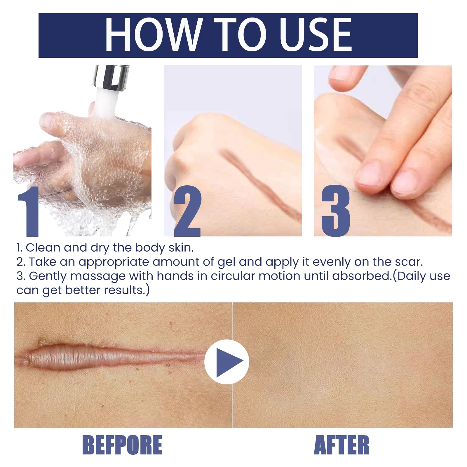 EELHOE Silicone Skin Scar Gel Retinol Niacinamide Scars Stretch Marks Burn Marks Deeply Nourish Skin Reduce Redness Swelling 30g Zpaxo