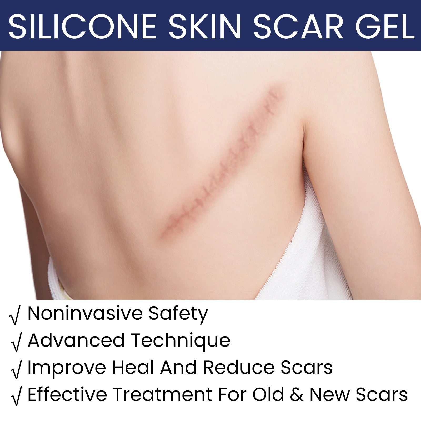 EELHOE Silicone Skin Scar Gel Retinol Niacinamide Scars Stretch Marks Burn Marks Deeply Nourish Skin Reduce Redness Swelling 30g Zpaxo