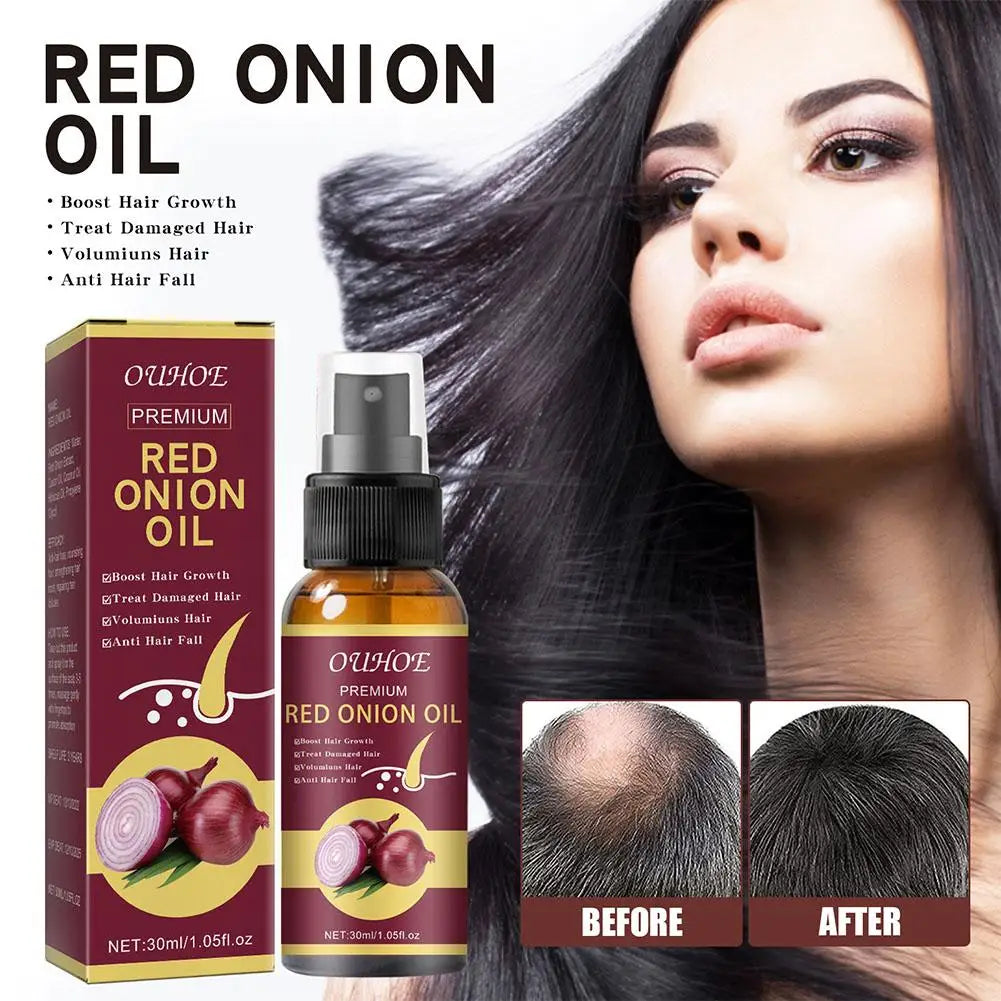 1/2/3pcs Red Onion Hair Care Essential Oil Hair Care Spray Nourish Hair Roots Improve Hair Texture Hair Care Zpaxo