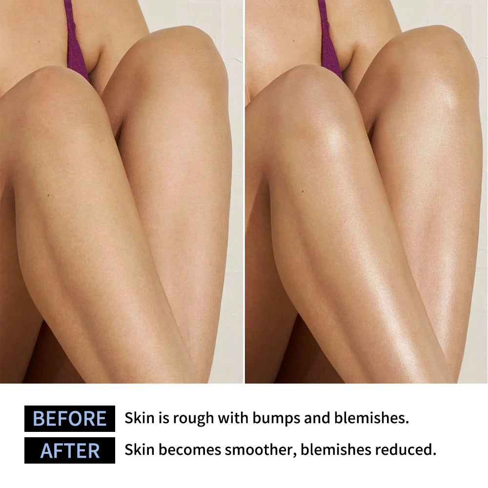 Glycolic Acid Exfoliating Body Stick Multiple Concerns Delivers Deep Effective Exfoliation Nourishing Moisture Deep Hydration Zpaxo