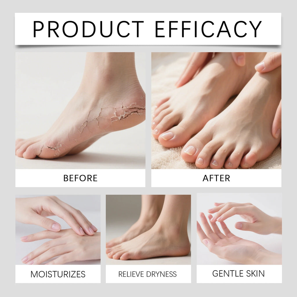 Christmas Hand Foot Moisturizing Stick for Dry Cracked Skin Holiday Gift Set Urea & Salicylic Acid Foot Cream Balm Cold Weather Zpaxo