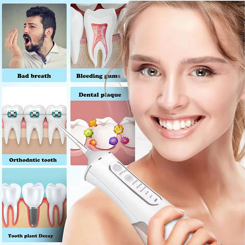 Portable Dental Water Flosser – USB Rechargeable Oral Irrigator Oral Irrigator Zpaxo