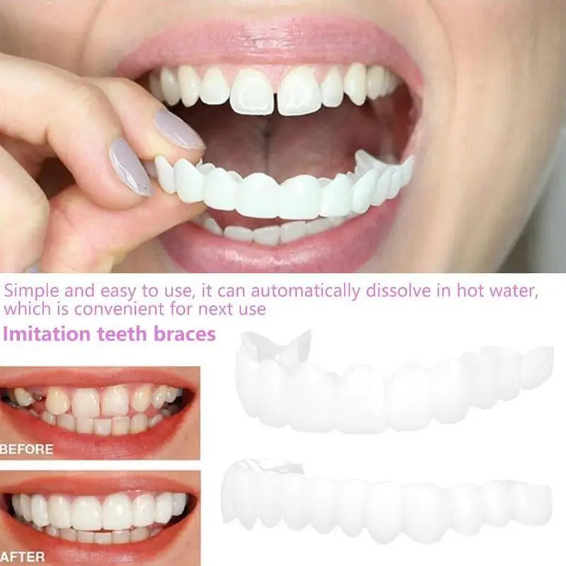 Snap-On Teeth Veneers – Reusable Temporary Smile Veneers Cosmetic Tooth Veneers Zpaxo