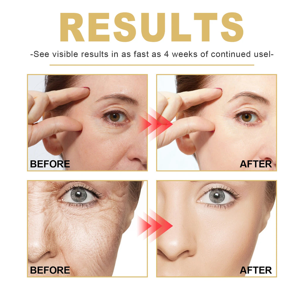 Golden Age Anti Aging Serum 30ml Wrinkle Reduction Face Serum With Pca Sodium Hydrating Firming Moisturizing Skin Care Essence Zpaxo