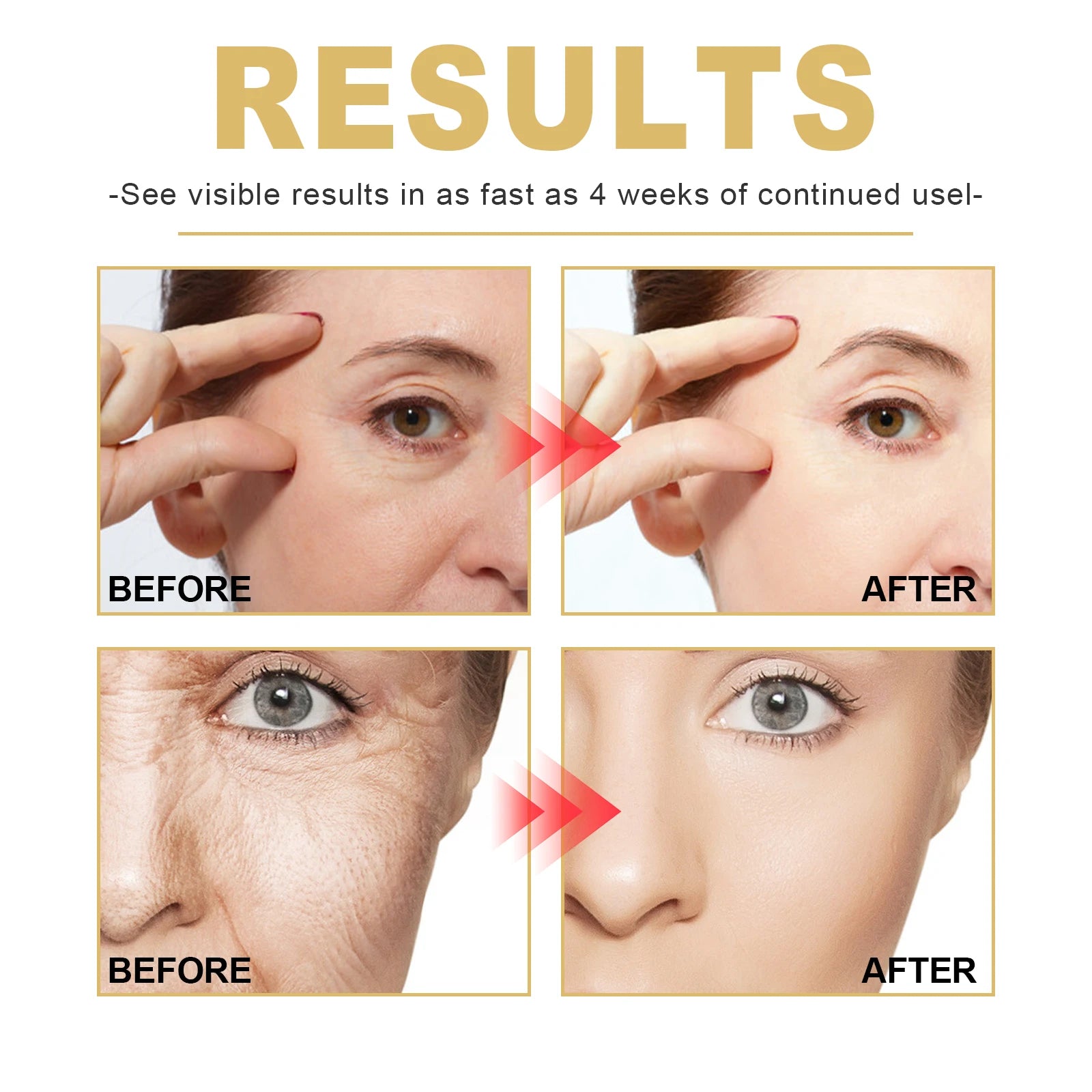 Golden Age Anti Aging Serum 30ml Wrinkle Reduction Face Serum With Pca Sodium Hydrating Firming Moisturizing Skin Care Essence Zpaxo